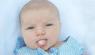 Cara Menghilangkan Putih Di Lidah Bayi dan Penyebabnya Cara Menghilangkan Putih Di Lidah Bayi dan Penyebabnya