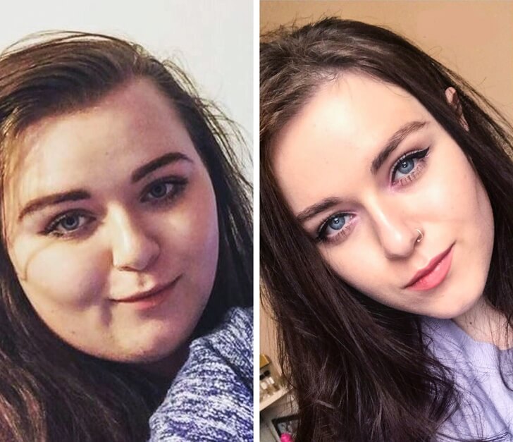 16 Before And After Pictures Of People Who Lost Weight And Became Unrecognizable
