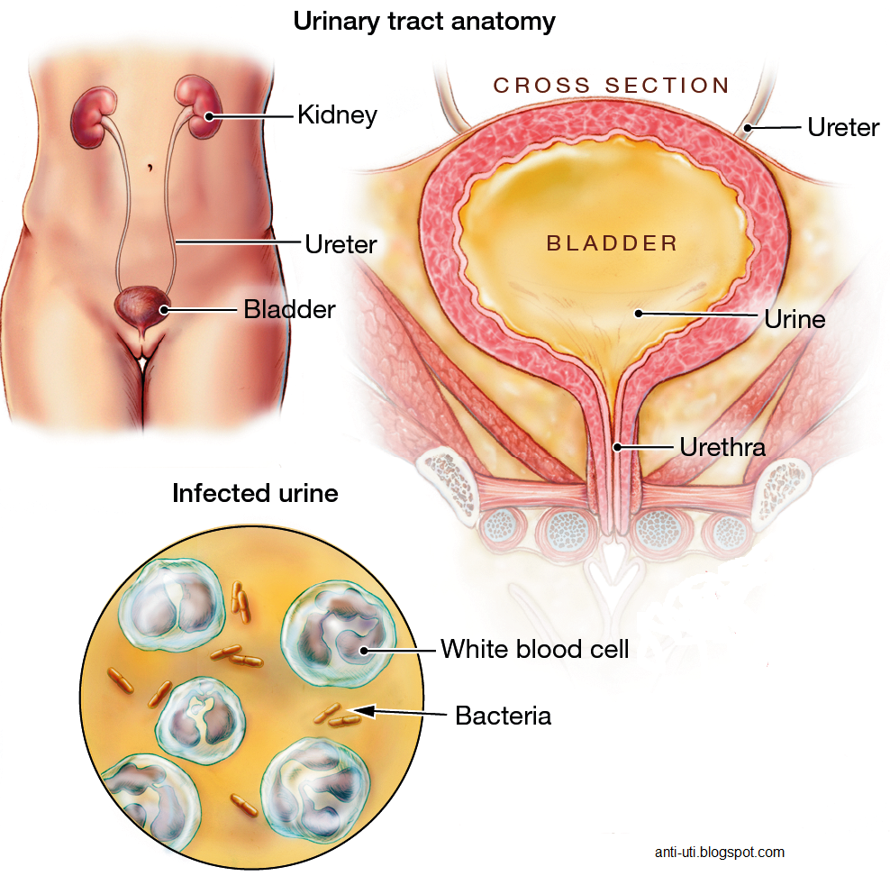bladder infection from sex bladder infection from sex