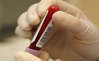 8-type-of-cancer-can-be-detected-by-new-blood-test