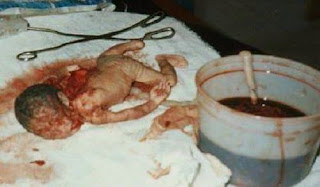 Aborted Human Fetal Cells in Your Food And Cosmetics