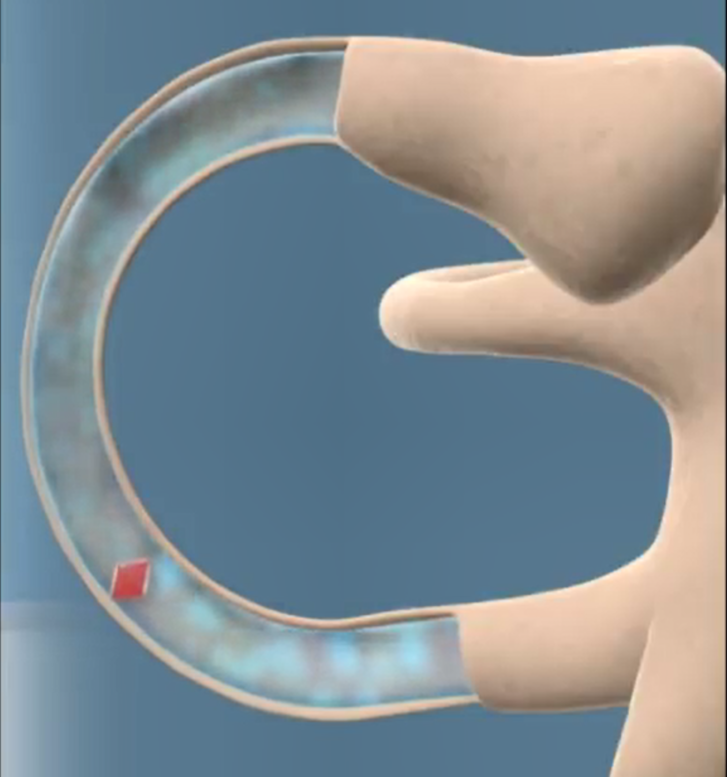 reflections-my-vertigo-treatment-epley-maneuver