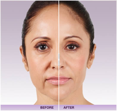 There are every day ways to keep our skin looking good - Beauty tips There are every day ways to keep our skin looking good - Beauty tips