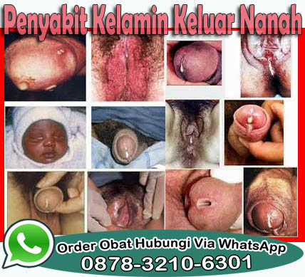 Obat Kencing Sakit Di Apotik De Nature Obat Kencing Sakit Di Apotik De Nature
