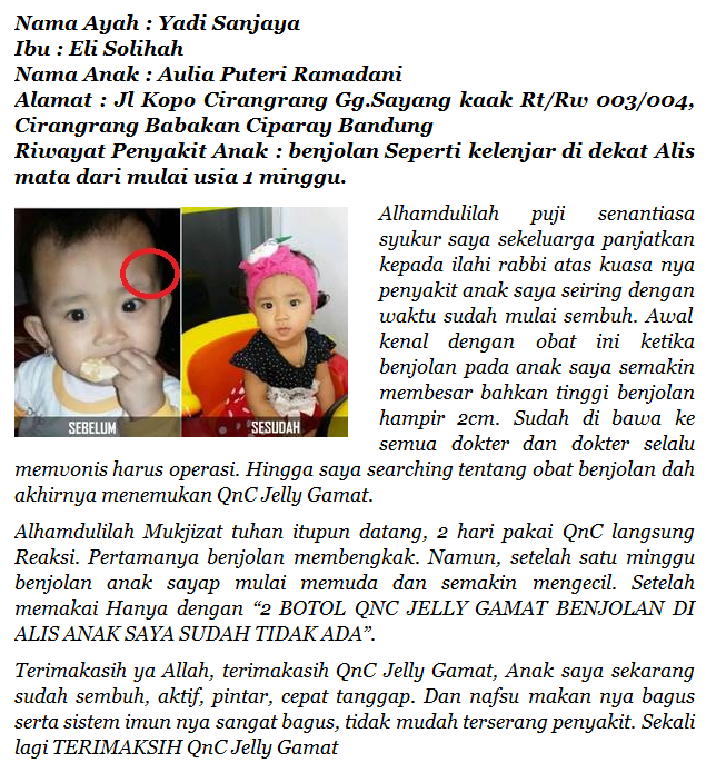 Obat Penghilang Benjolan di Daun Telinga ini PALING AMPUH dan No.1 Di Indonesia Obat Penghilang Benjolan di Daun Telinga ini PALING AMPUH dan No.1 Di Indonesia