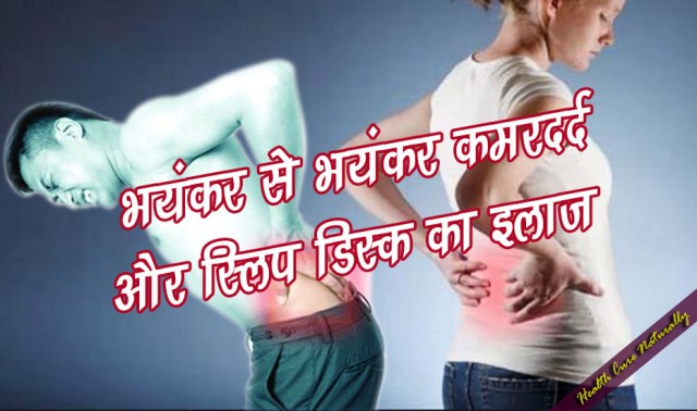 भयंकर से भयंकर कमरदर्द और स्लिप डिस्क का इलाज : Backpain & Slip Disk Home Remedy भयंकर से भयंकर कमरदर्द और स्लिप डिस्क का इलाज : Backpain & Slip Disk Home Remedy