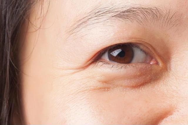 Chị em U40 trẻ lại 10 tuổi nhờ tinh dầu và đá lạnh Chị em U40 trẻ lại 10 tuổi nhờ tinh dầu và đá lạnh