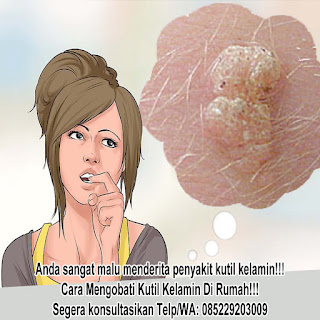 4 Jenis Obat Kutil Kelamin Dokter Terpercaya Alami Di Apotik Kimia Farma yang Bisa Anda Coba 4 Jenis Obat Kutil Kelamin Dokter Terpercaya Alami Di Apotik Kimia Farma yang Bisa Anda Coba