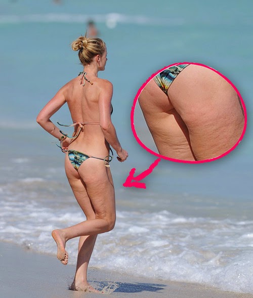 O horror! Modelo da Victoria's Secret apanhada a abanar a celulite na praia!