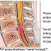 pengobatan saraf terjepit