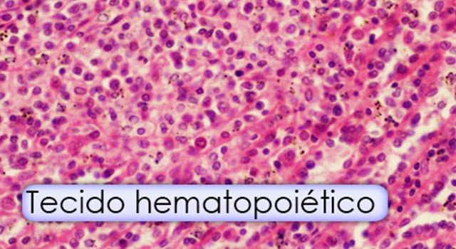 Só Patologias: Patologias do Tecido hematopoiético