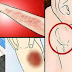 MUST READ: 15 Cancer Warning Signs And Symptoms That Most Of Us Ignore Until It's Too Late.