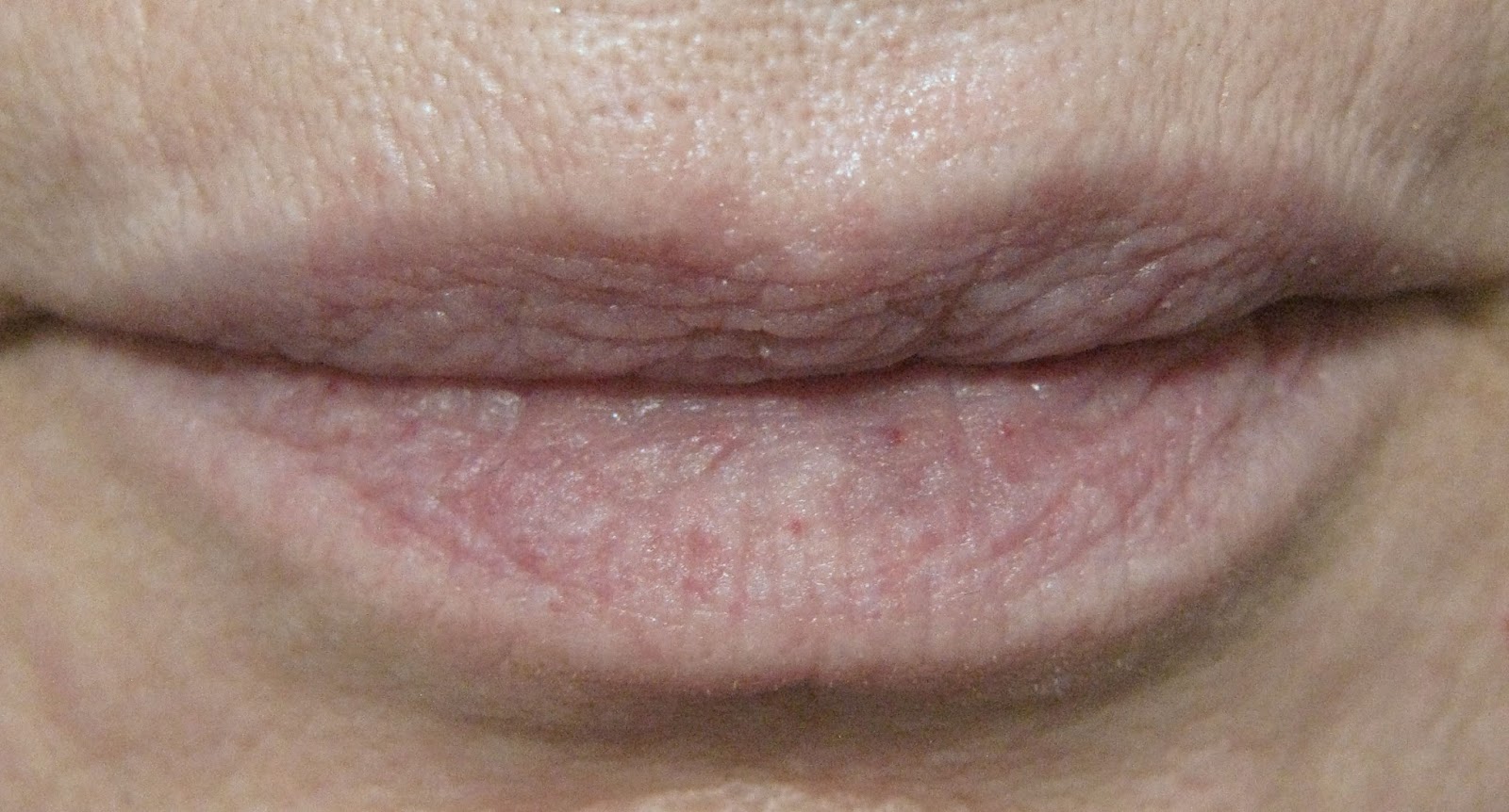 Polarbelle Enhance Your Lips Without Injections Using The PMD Kiss