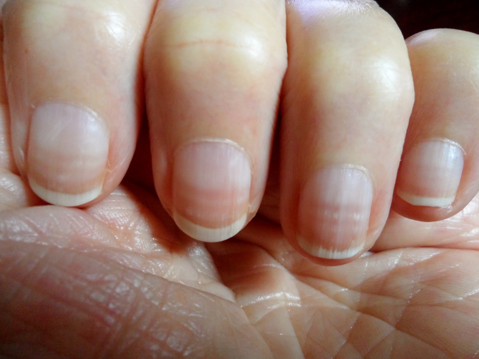 vertical splitting nails #11