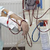 ΕΟΠΥΥ: Λιγότερη ταλαιπωρία για τους αιμοκαθαιρόμενους από 1η Οκτωβρίου