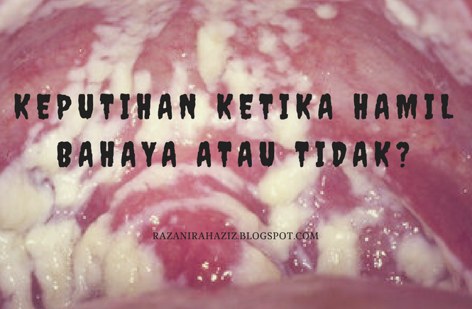 17+ Arti Mimpi Keluar Keputihan Banyak