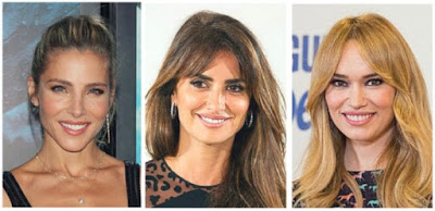 celebrities con carillas dentales