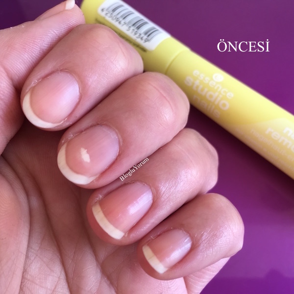 essence studio nails nail cuticle remover pen öncesi