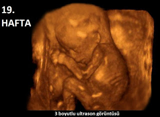 hamileliğin 19. haftası ultrason