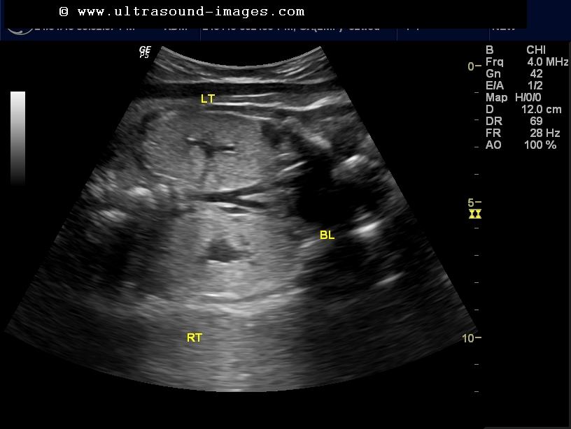 cochinblogs Quiz fetal kidneys in 34 weeks pregnancy