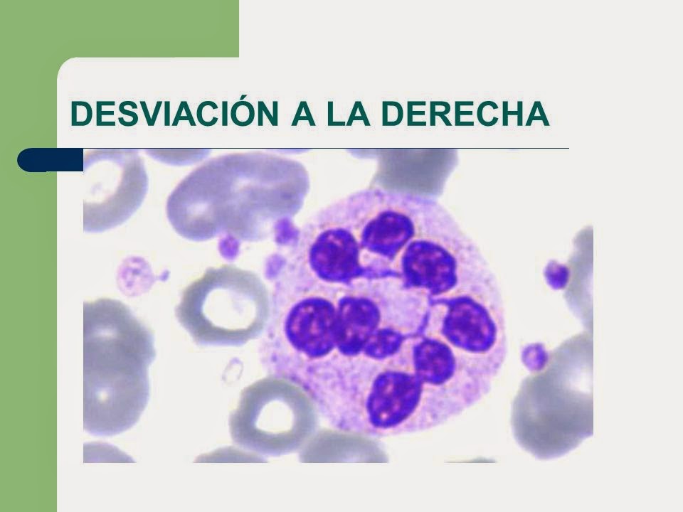 fichero hematologia Desviación a la derecha fichero hematologia Desviación a la derecha