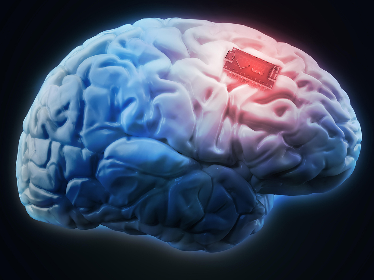 Os humanos serão ligados a maquinas com a implantação da tecnologia Neural Lace Brain Chip Os humanos serão ligados a maquinas com a implantação da tecnologia Neural Lace Brain Chip