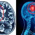 This Plant Proven To Treat 75% Of Tumors And Scientists Confirms Tumors Never Grows Back