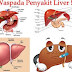 Paket Herbal Penyakit Liver