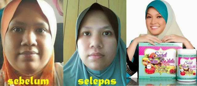Hasil carian imej untuk secret skin white kawaii