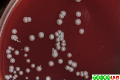 “Diphtheroid” colonies with rough edges, dry appearance, and umbonate center growing on blood agar. “Diphtheroid” colonies with rough edges, dry appearance, and umbonate center growing on blood agar.