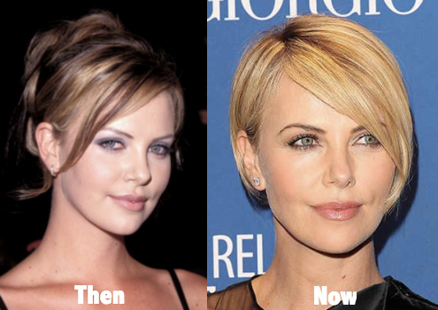 celebplasticsurgerygossip charlize theron plastic