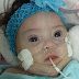 Mesmo com decisão judicial, bebê espera cirurgia cardíaca há 3 meses em Ceilândia