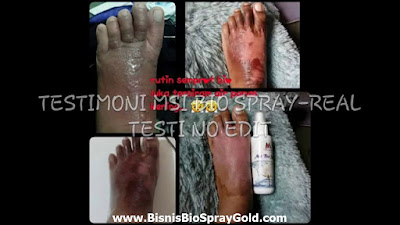Testimoni MSI Bio Spray - Multy Spray Testimoni MSI Bio Spray, Testimoni MSI Multy Spray
