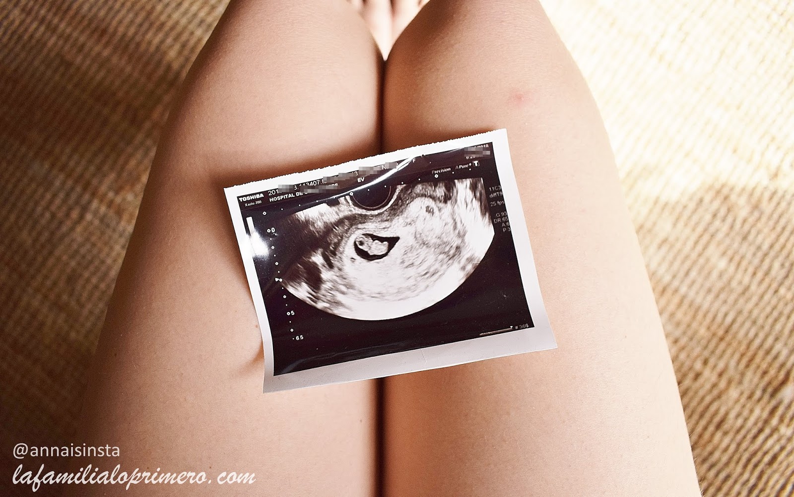 sintomas del segundo trimestre de embarazo