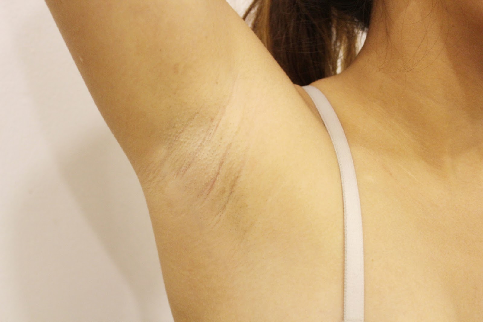 Nano Laser Painless Hair Removal Treatment Fleek Eyebrow