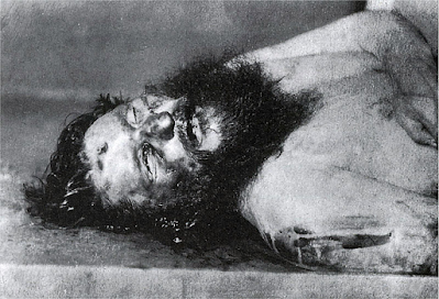 Rasputin: Bullet Wound in Forehead