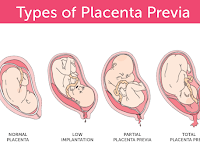 Placenta Diagram Placenta Diagram