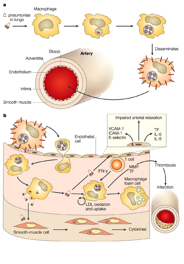 Atherosclerosis Pathogenesis