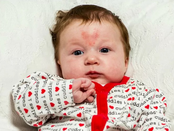 World For Anon People With Their Strange Birth Marks