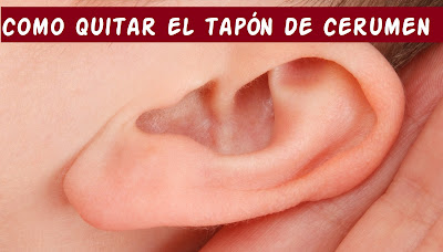 Quitar tapon de cera con jeringuilla