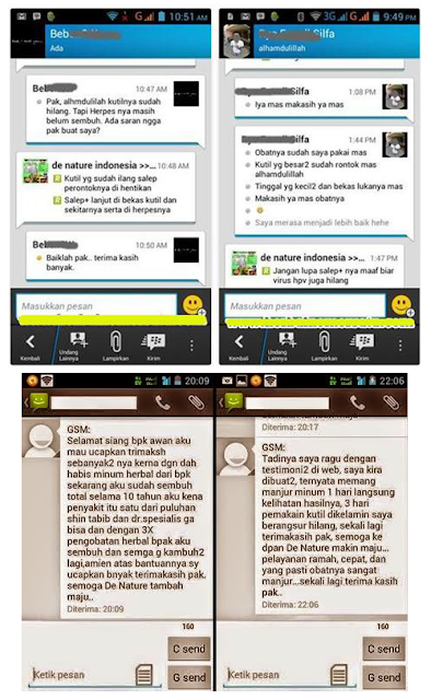 Seperti Apa Ciri Penyakit Kutil Pada Kelamin Seperti Apa Ciri Penyakit Kutil Pada Kelamin