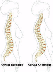 curvas columna embarazo