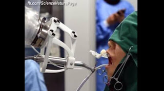 Στην Κίνα Ρομπότ πραγματοποίησε την πρώτη εμφύτευση δοντιών σε ασθενή