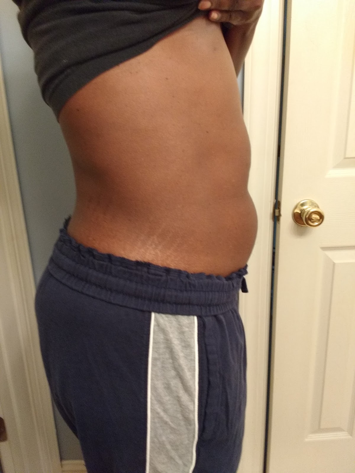 How I Am Shrinking My Fibroids The �Watch and Wait