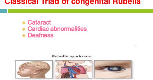 Congenital Rubella Syndrome.