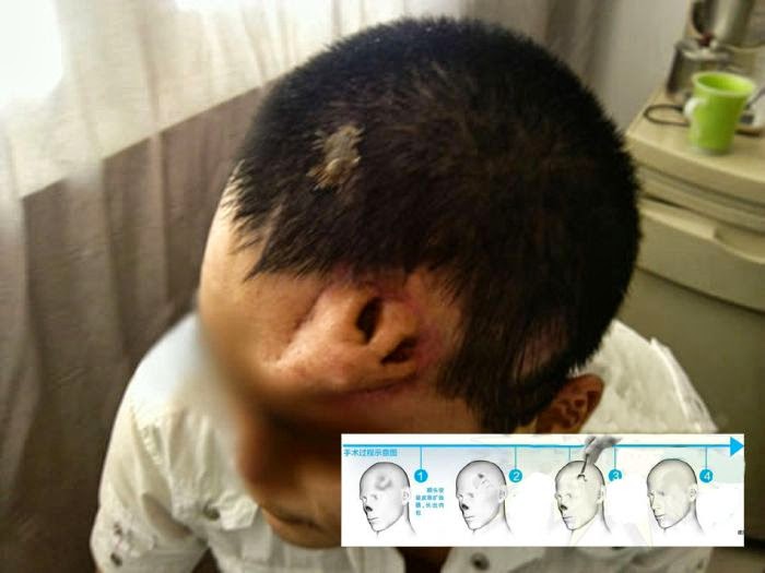 Man growing nose on forehead with Apologise, that man growing nose on forehead