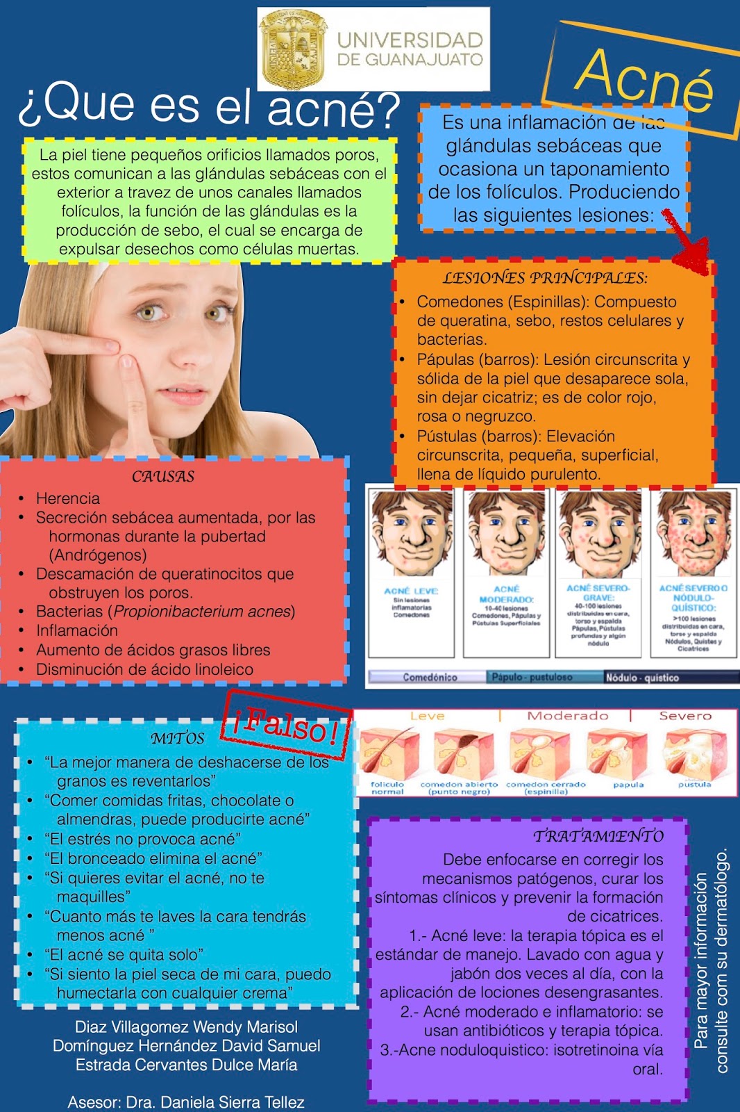 ¿Qué es el acné? MEDICINA INTERNA FASE 2