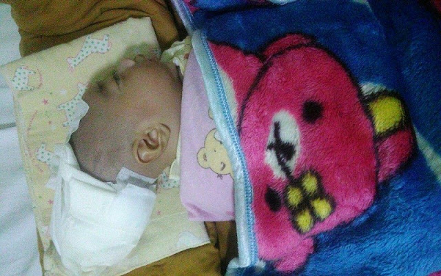 Diduga Salah Penanganan Medis Kepala Bayi ini Tersayat Pisau Saat Lahiran Diduga Salah Penanganan Medis Kepala Bayi ini Tersayat Pisau Saat Lahiran