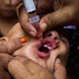 Right Way To Manage Polio Drops Vaccination in Pakistan