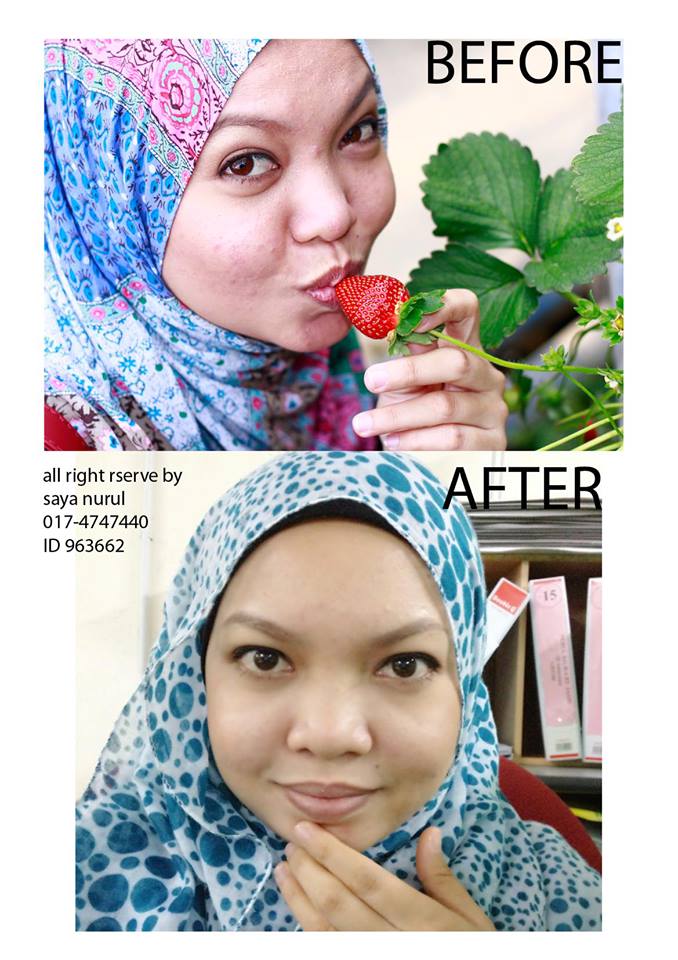 parut+jerawat.jpg